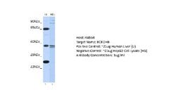 BCKDHB Rabbit anti-Human, Polyclonal, Novus Biologicals 0.1 mL | Buy Online | Novus Biologicals | Fisher Scientific